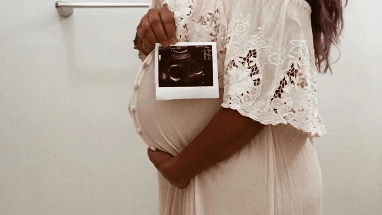 pregnant woman holding belly and an ultrasound