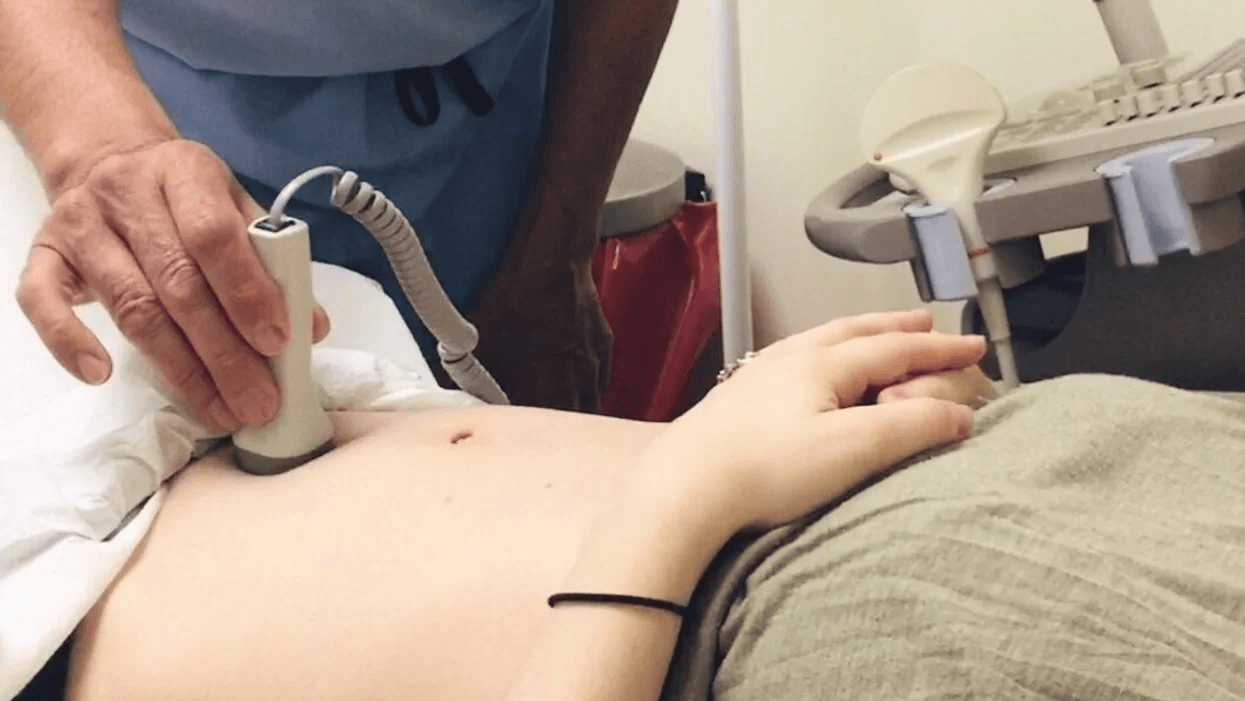 woman getting an ultrasound