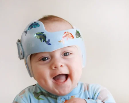 everything you need to know about your babys plagiocephaly helmet featured Motherly