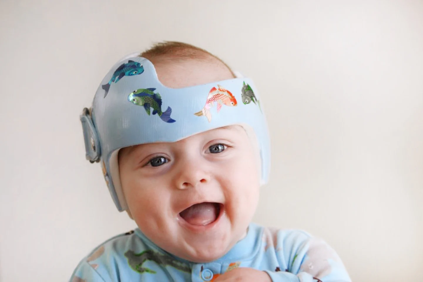 everything-you-need-to-know-about-your-babys-plagiocephaly-helmet-featured