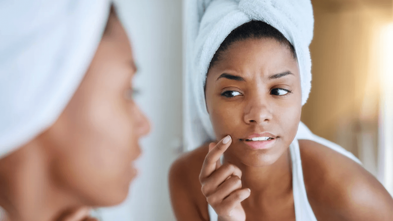 woman checking out skin in a mirror