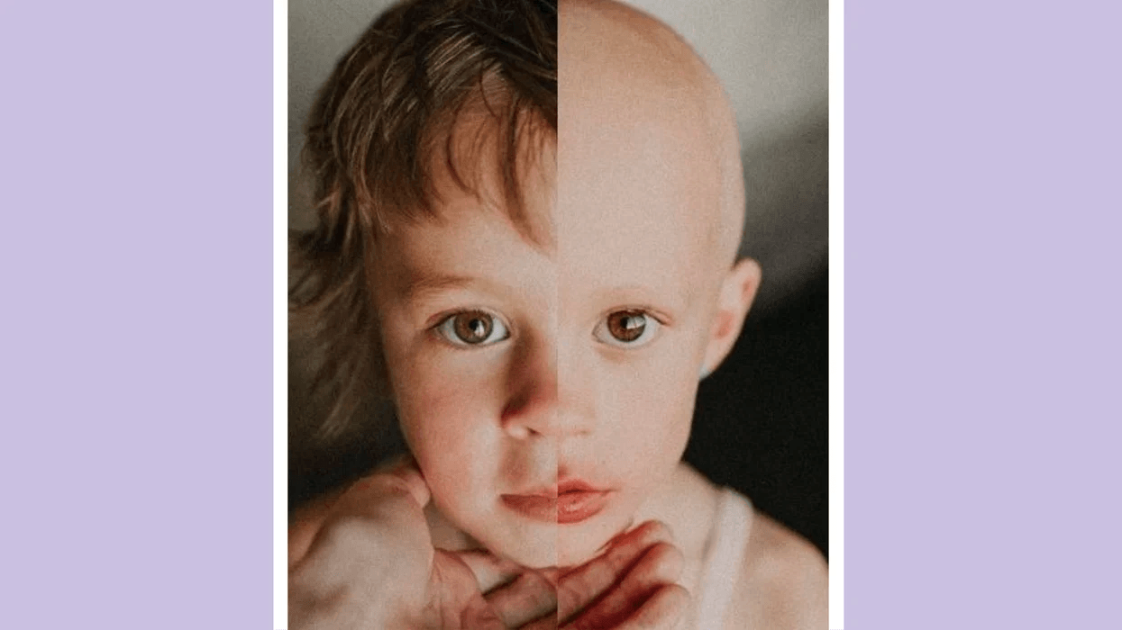 side by side of a child going through cancer