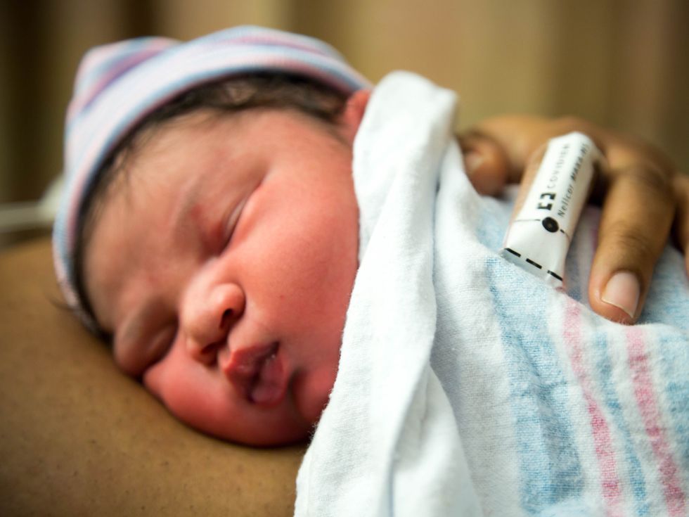 baby born after unexpected c-section