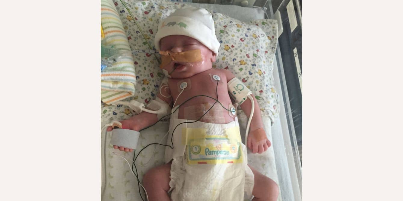 little baby hooked up to machines in the NICU - essay on postpartum PTSD