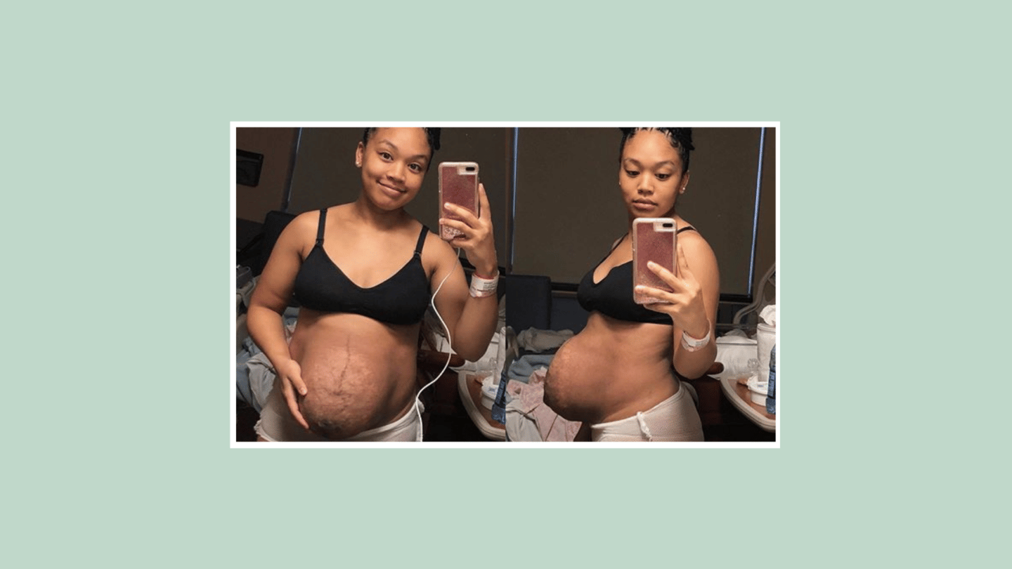 Samantha McSwain posting postpartum selfie