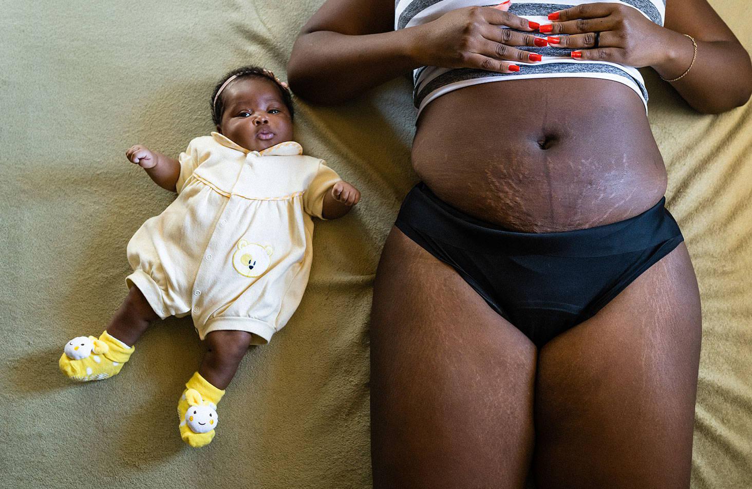 Postpartum Photos: Beautiful Photos Celebrating Postpartum Bodies