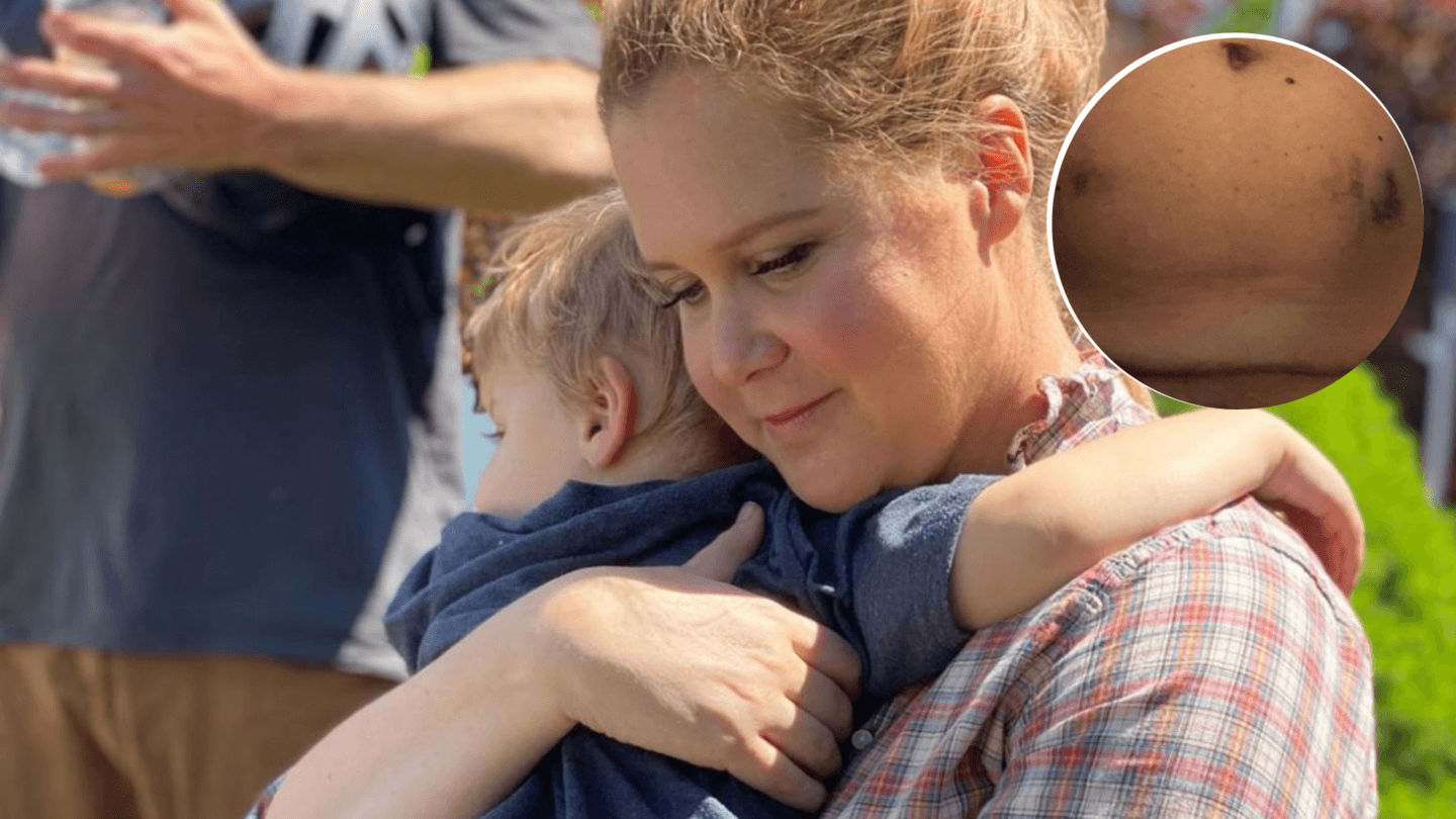 Amy Schumer embraces son Gene