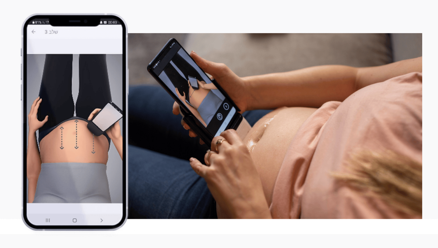 Could at-home ultrasounds soon be part of prenatal care? 1 Pulsenmore