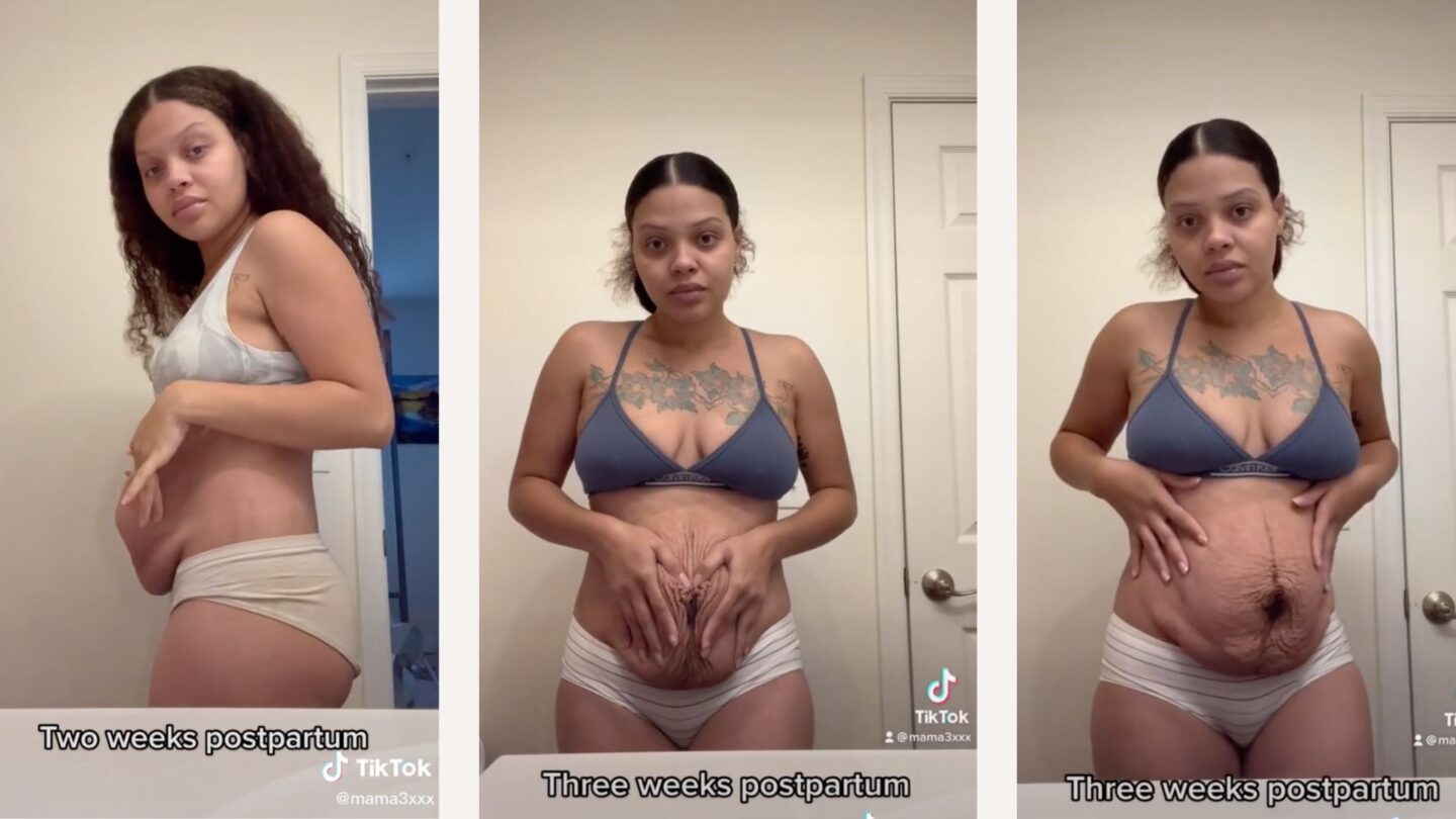 A postpartum photo of 4 moms got thousands of negative comments