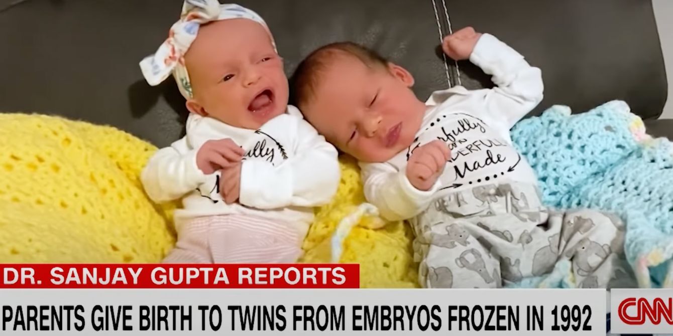 twins 30 year old embryos-twins born from frozen embryos