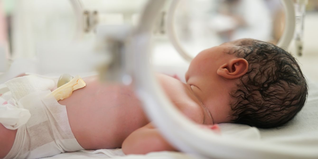 premature newborn sleeps in nicu - preterm birth drug Makena pulled by FDA