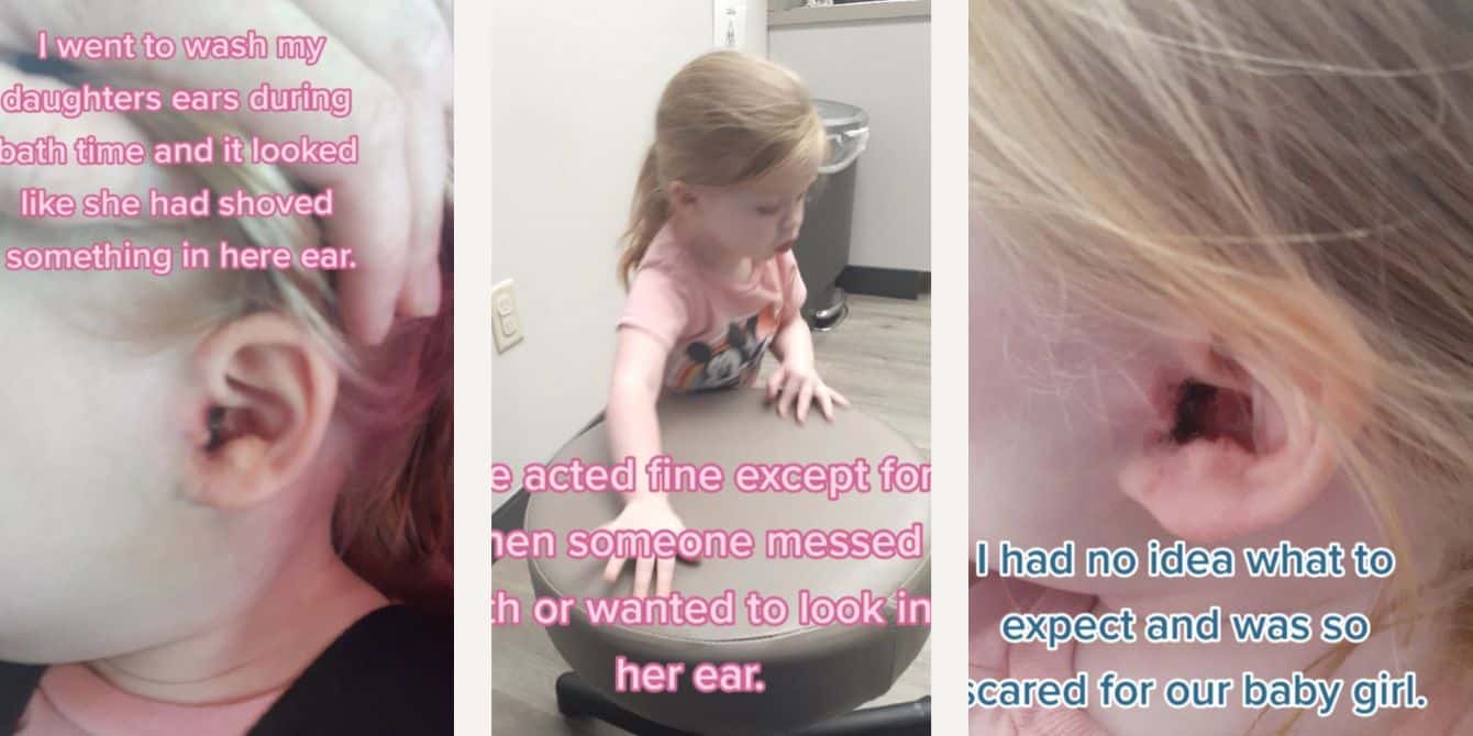 Little girl has tick stuck in her ear
