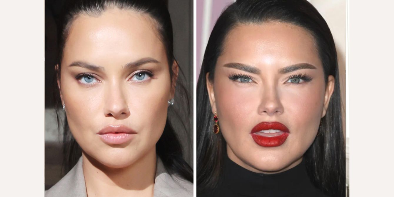 New Mom Adriana Lima Responds To Criticism Over Her Face Motherly