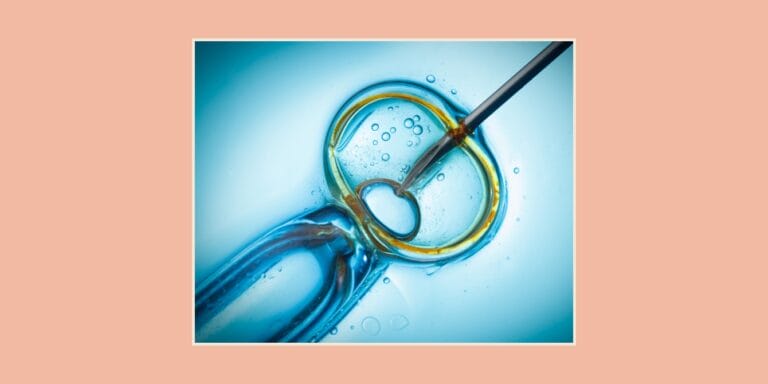 ivf