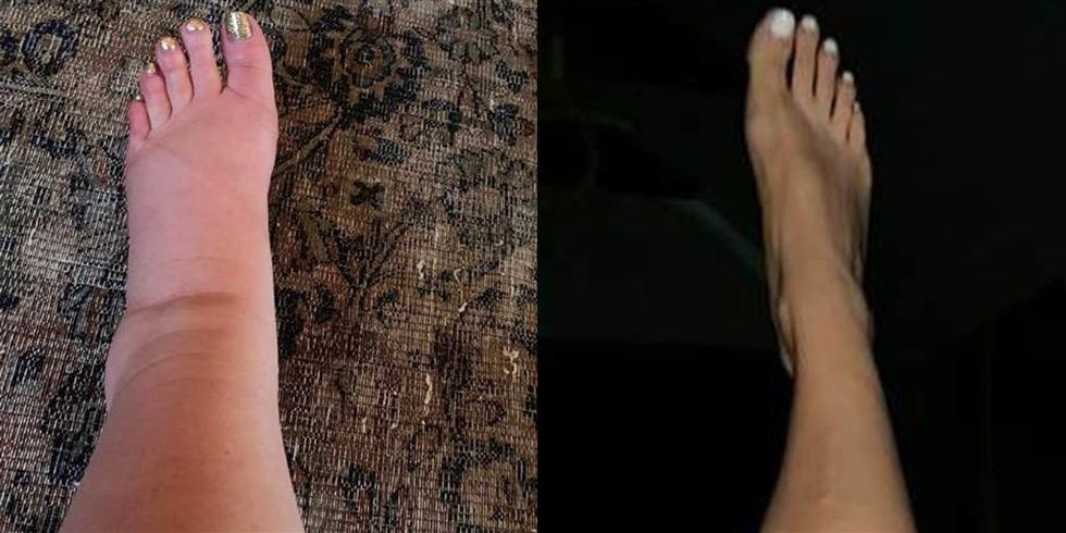 jessica simpsons asked the internet for help with her swollen feet 0 Motherly