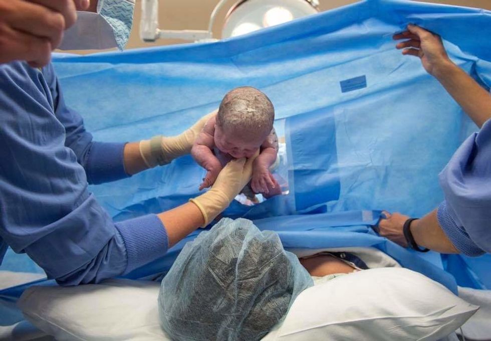 what went viral this week moms helping moms gentle c sections beautiful baby helmets 0 Motherly